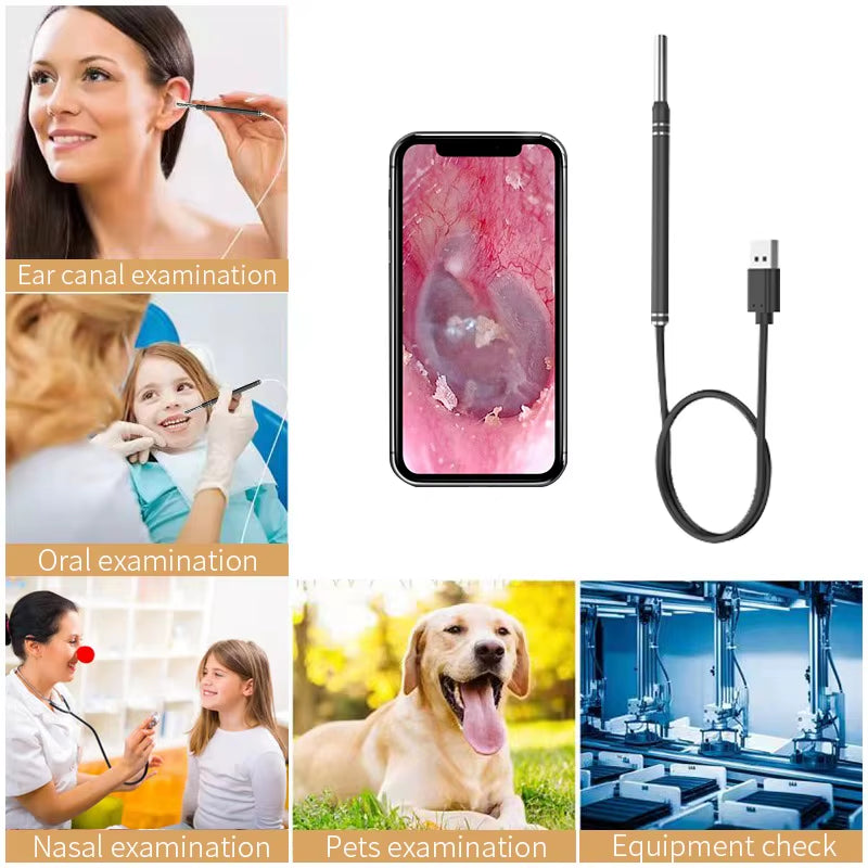 Smart Ear Cleaner Endoscope Spoon Camera Picker Cleaning Wax Removal Visual Earpick Nose Otoscope for Samsung Xiaomi Android DIY