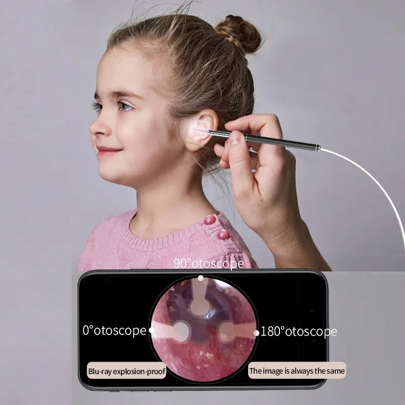 Smart Ear Cleaner Endoscope Spoon Camera Picker Cleaning Wax Removal Visual Earpick Nose Otoscope for Samsung Xiaomi Android DIY