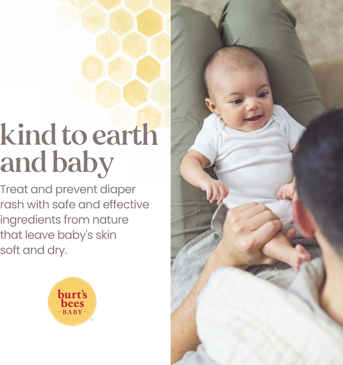 Baby Diaper Rash Ointment Maximum Strength, 40% Zinc Oxide, 100% Natural Origin, Pediatrician Tested, 85G