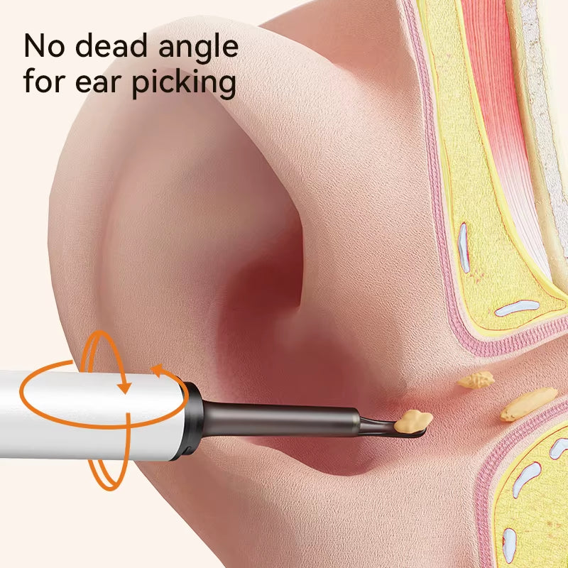 DDCAMERA Smart Ear Wax Removal Ear Cleaner with Ear Cleaning Tool 2.0MP HD Camera Light Ear Wax Removal Kit Endoscope Otoscope
